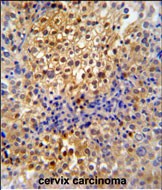 IHC-P - PR38A Antibody  (C-term) AP9930b